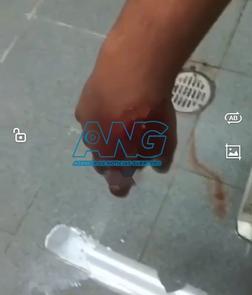 Turista sobrevive a mordida de cocodriloen zona turística de Guerrero