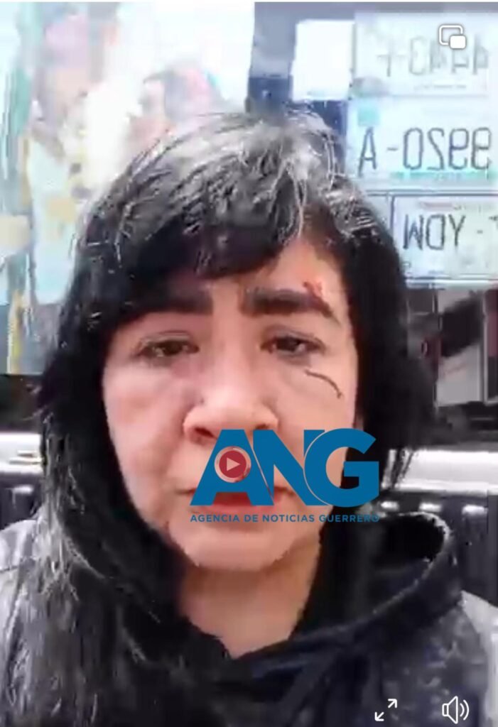 Denuncia activista de Morena en Guerrero agresión por parte de su pareja Romel Leal