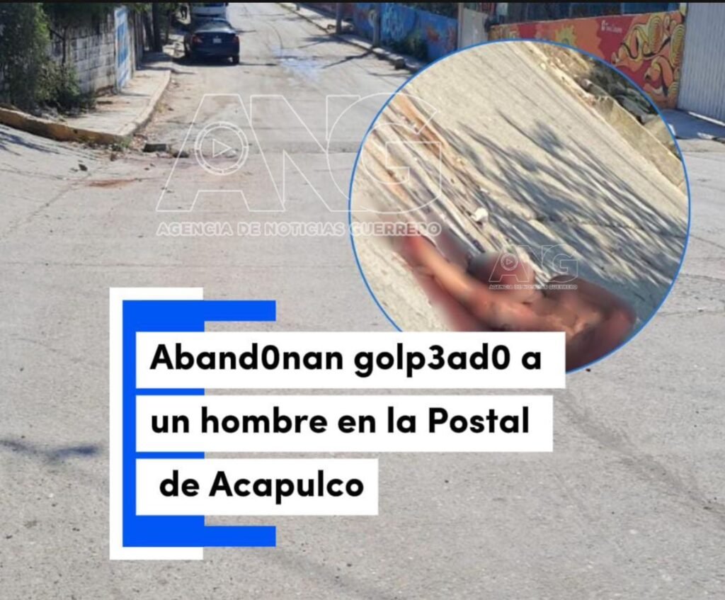 Aband0n4n golpe4do a un hombre en la Postal de Acapulco